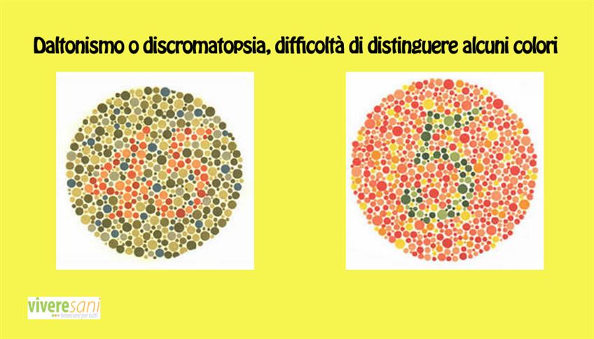 Daltonismo Daltonismo